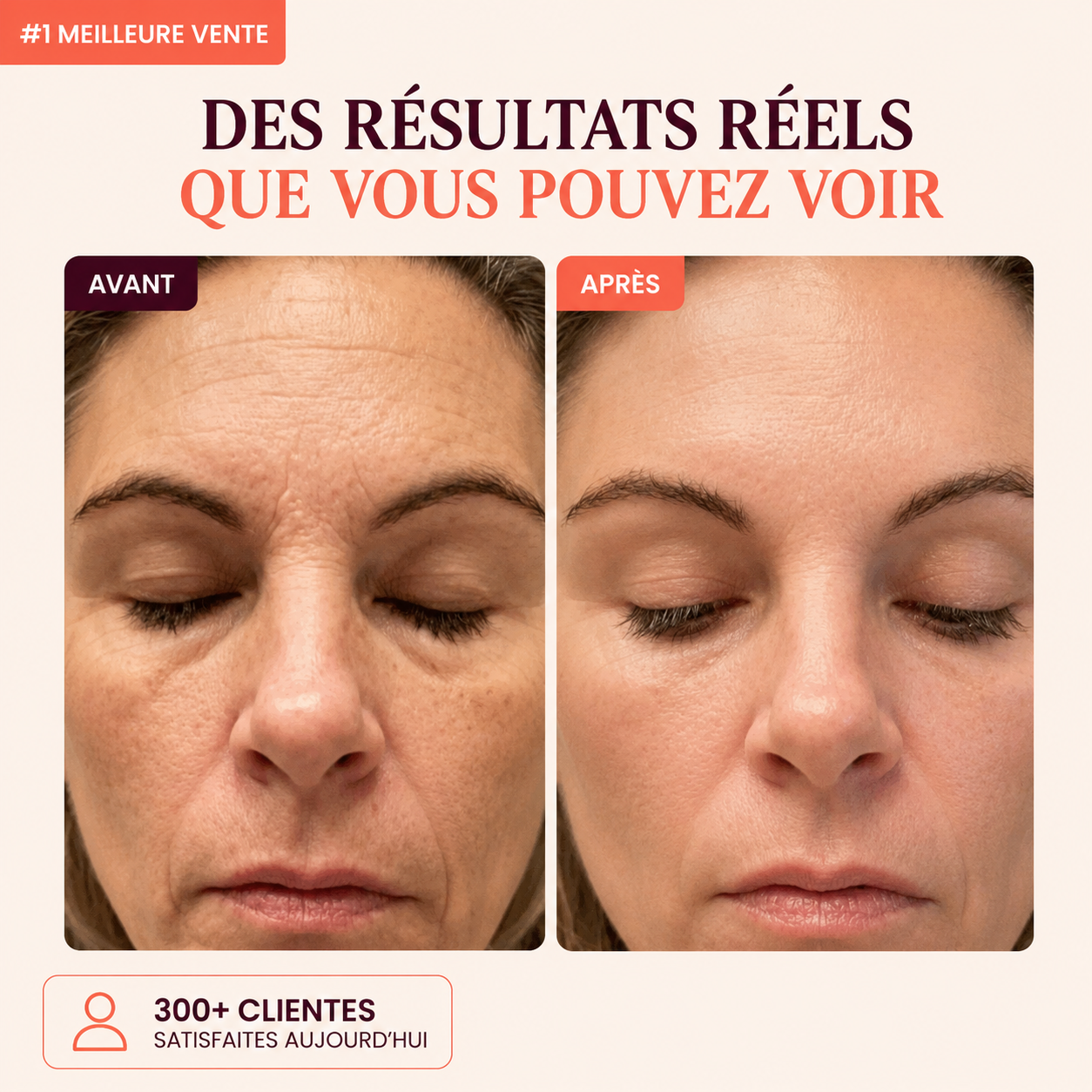 Baume Repulpant & Réparateur au Collagène