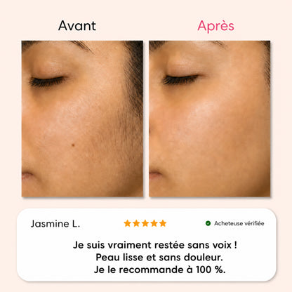 Soleya - Coffret complet d'épilation
