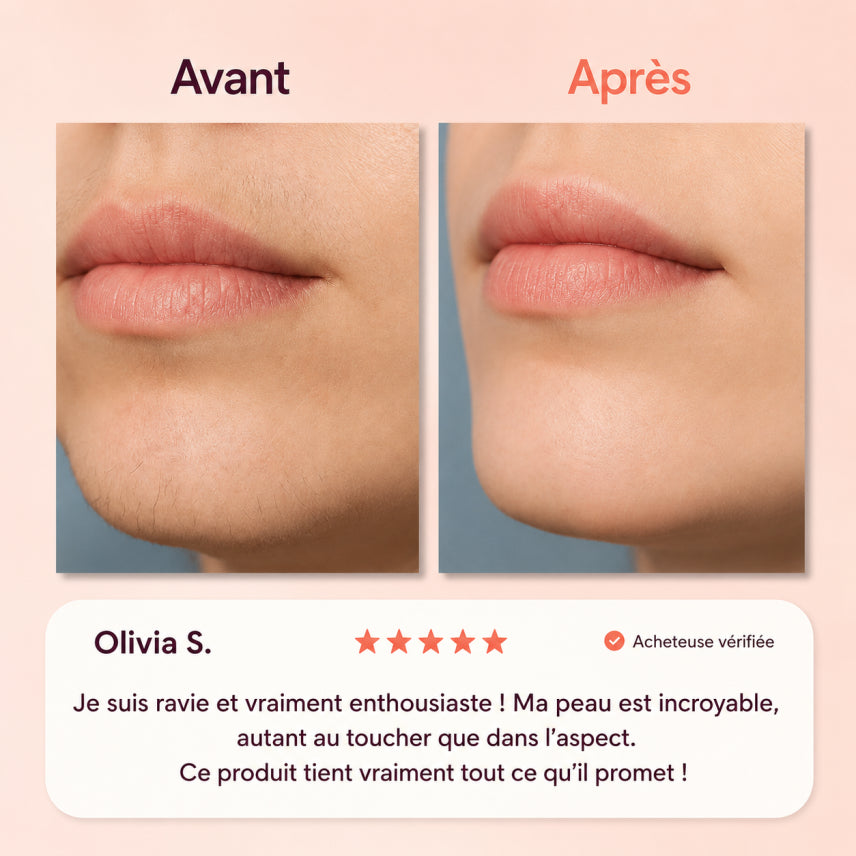 Soleya - Coffret complet d'épilation