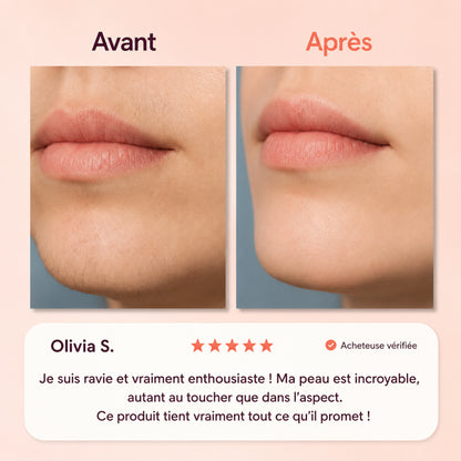 Soleya - Coffret complet d'épilation